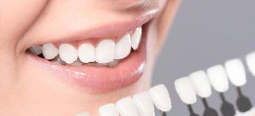 ¿De qué se compone un Blanqueamiento Dental?