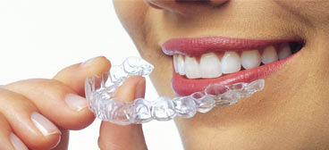 INVISALIGN, FÉRULAS INVISIBLES