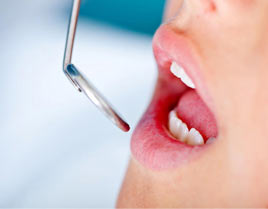 Proceso en una endodoncia