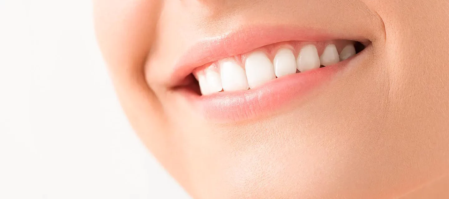 Blanqueamiento Dental: Recomendaciones